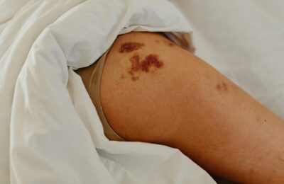 skin lumps on arm